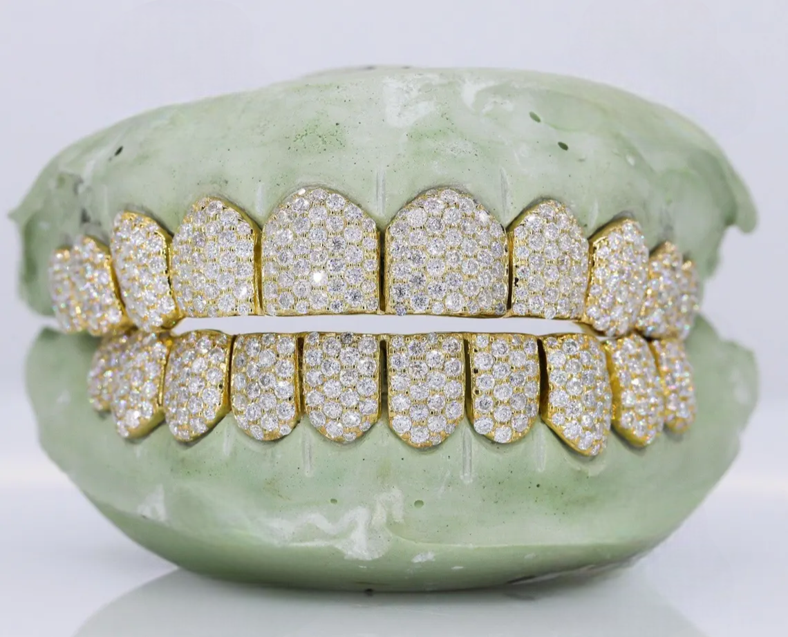 Silver Iced Out VVS Moissanite Diamond Custom Hip Hop Teeth Statement Jewelry