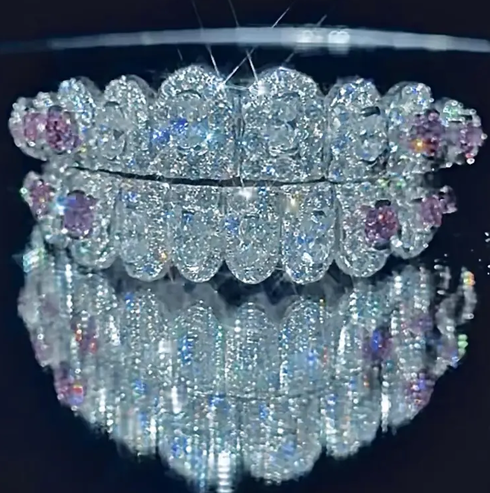 Iced Out 925 Silver Moissanite Diamond Luxury Grillz