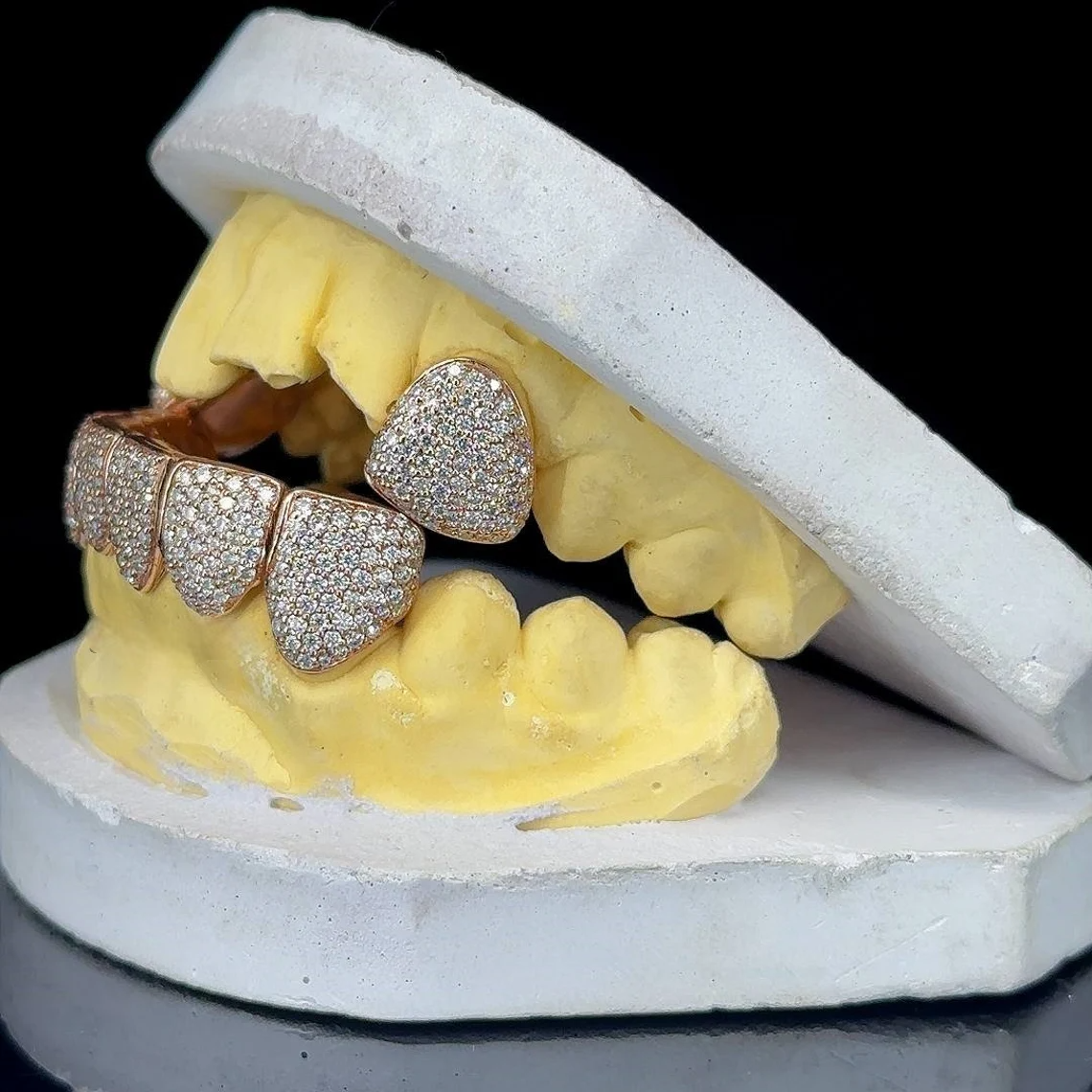 Iced Out Custom VVS Moissanite Diamond 925 Silver Grillz